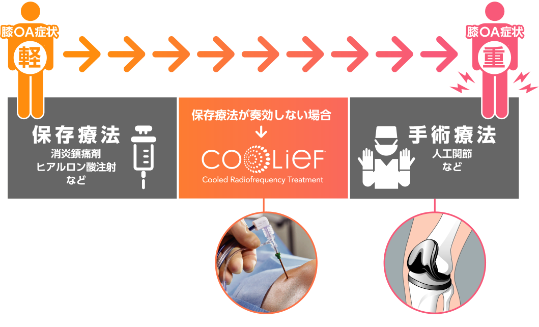 Coolief（クーリーフ）治療の対象